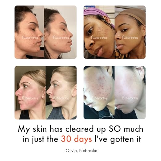 Filterbaby Skincare Filter 2.0, Bathroom Sink Filter Water Faucet for Skin Care, Clinically Tested Starter Kit, Filter w/10 Faucets Adaptors, Sink Water Filter for Skin Protection (Light Pink)